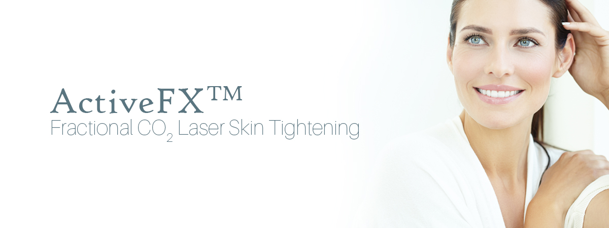 ActiveFX laser treatment in progress